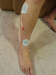 ZOPEC DT-1200 Peripheral Neuropathy and Body Pain System